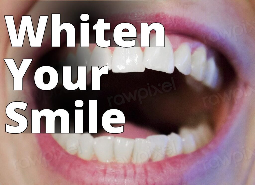 Free adult teeth closeup image - a woman's mouth with white teeth